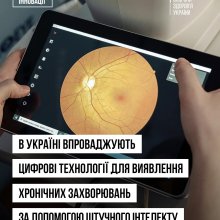 мв
