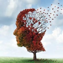 alzheimer